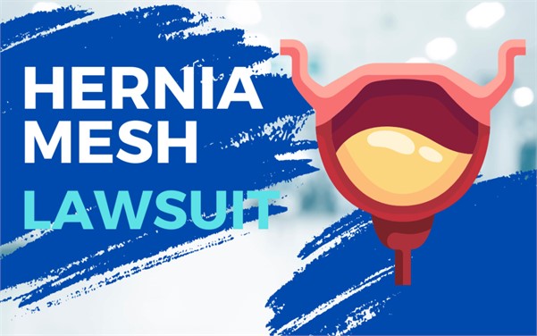 C.R. Bard Hernia Mesh Lawsuit